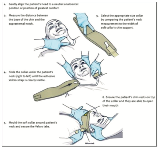 How to apply a soft collar